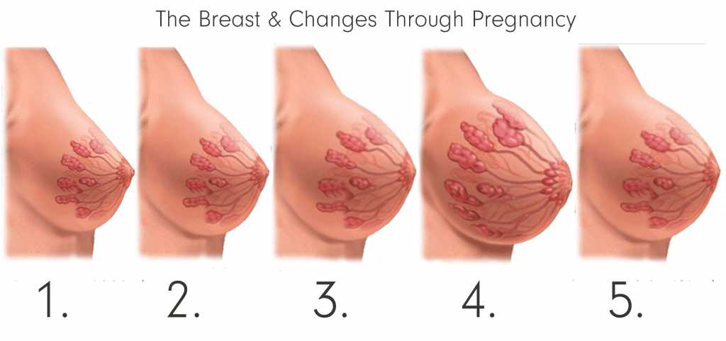 Изменение груди во время беременности