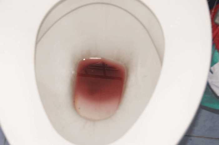 кровянистые выделения у мужчин из пениса