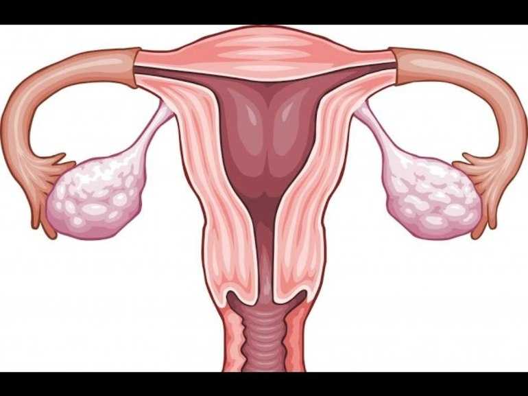 Дискомфорт во время менструации