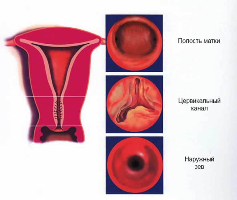Цервикальный канал у женщин где находится и что это такое рисунок