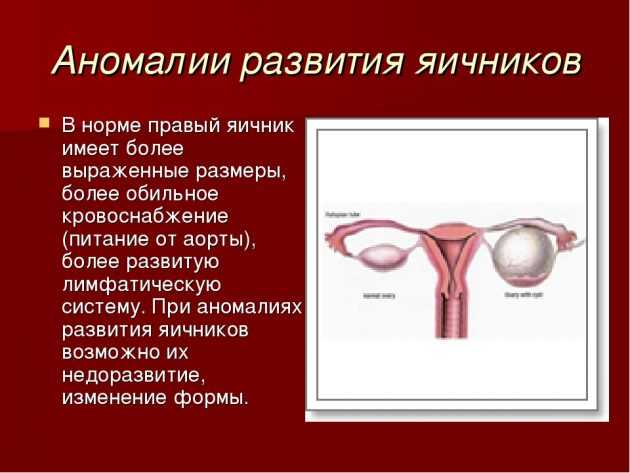 Гипоплазия яичников у женщин