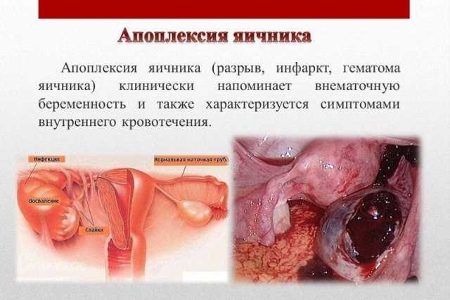 В середине цикла воспаление