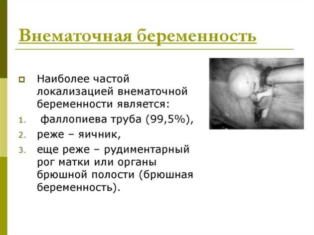 Задержка месячных и болит грудь