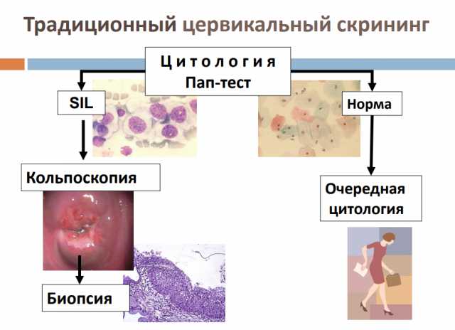 Мазок на онкоцитологию фото