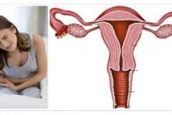 Как проявляется рак шейки матки у женщин