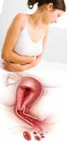 Симптомы миомы матки на ранних стадиях