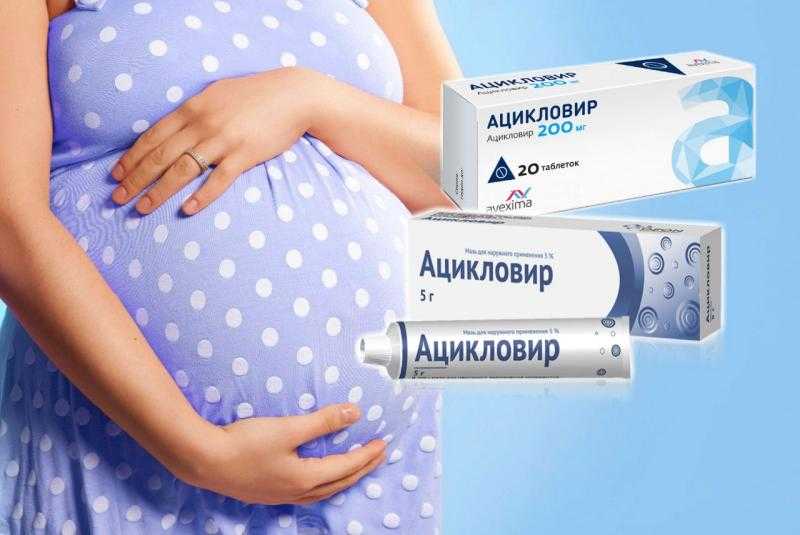 Ацикловир при беременности