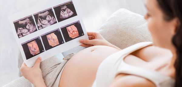 Беременная смотрит на снимки УЗИ