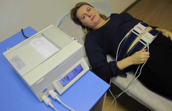 Беременная женщина лежит на кушетке с подключённым аппаратом КТГ