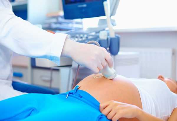 В кабинете УЗИ врач обследует беременную женщину