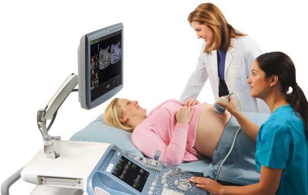 доплерография беременной