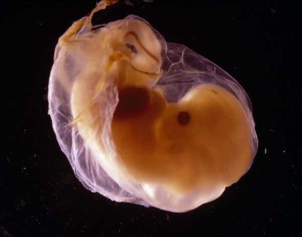Эмбрион в 8 недель