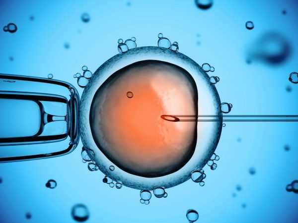 Процесс ввода сперматозоида в яйцеклетку специальной иглой