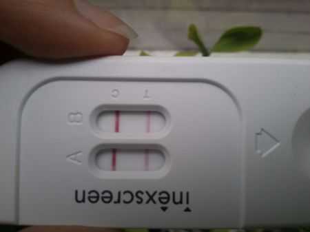 Inexscreen с результатом нормальной беременности
