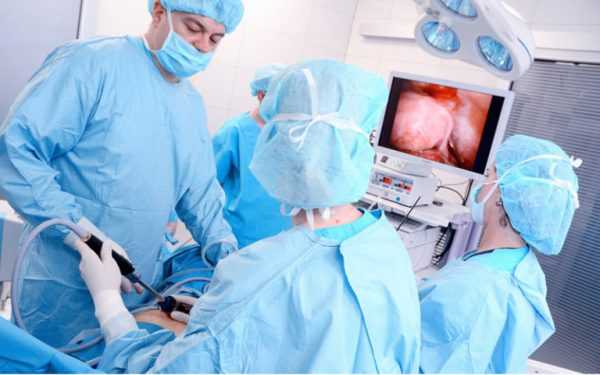 Лапароскопическая операция на матке
