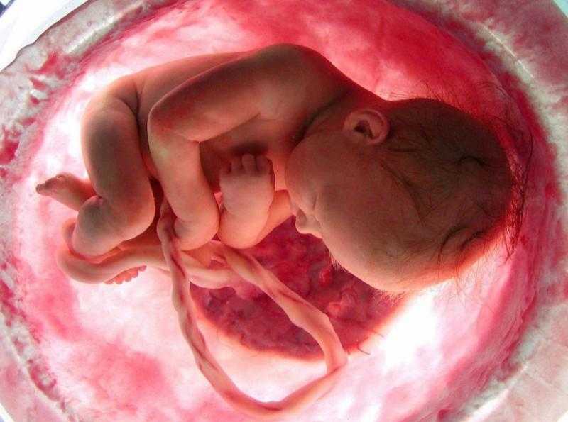 Плод и плацента в утробе