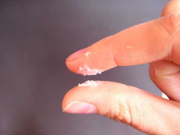 Выделения из влагалища во время молочницы на пальцах