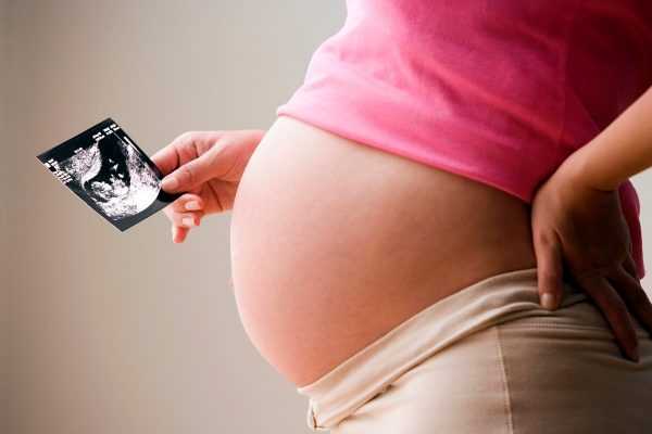 Беременная девушка держит снимок УЗИ