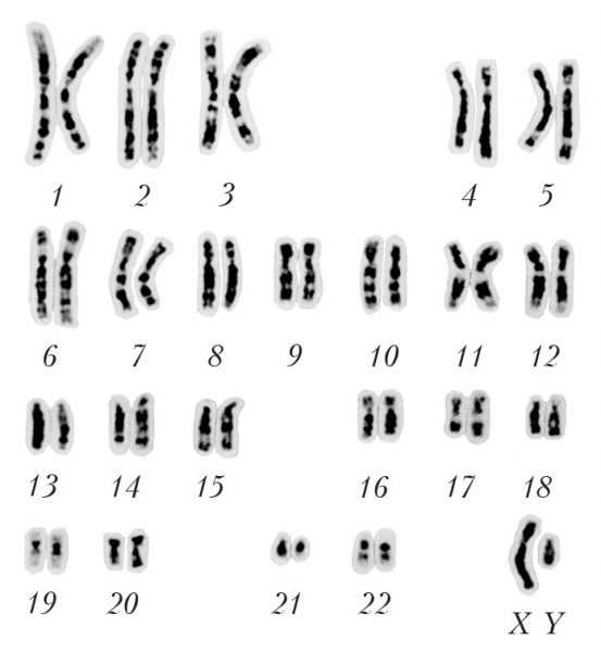 Кариотип человека картинка
