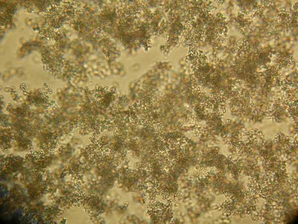 Кристаллы фосфатов в моче под микроскопом