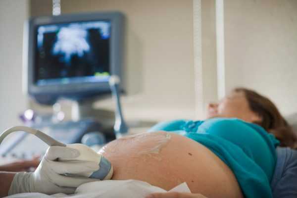 Процедура УЗИ при беременности