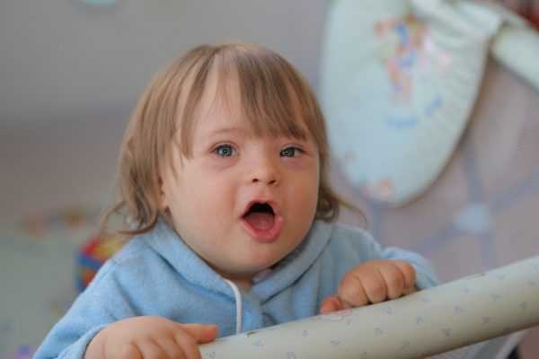 ребёнок с синдромом Дауна, стоит с открытым ртом