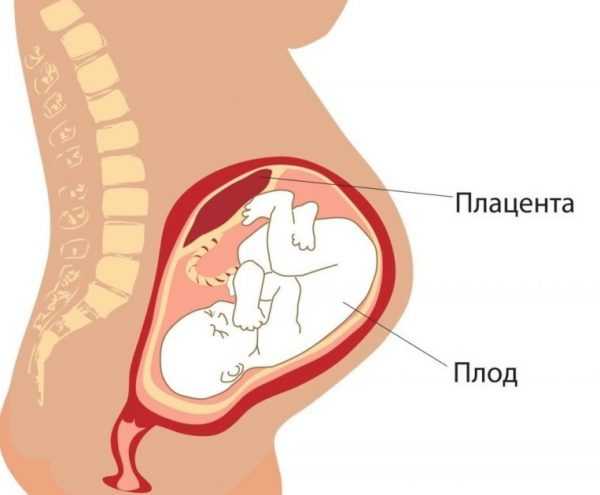Схематическое изображение расположения плаценты в беременной матке