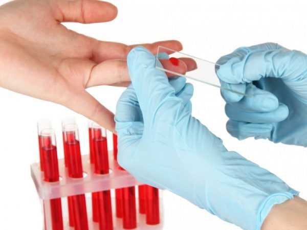 врач прикладывает предметное стекло к пальцу с каплей крови