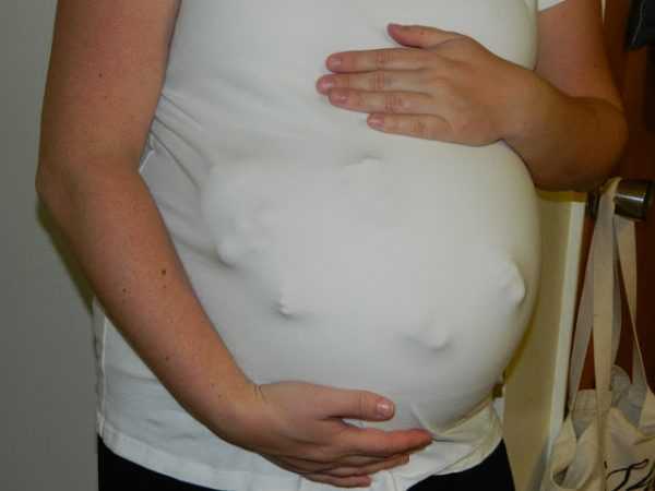 На животе беременной женщины проступают ладошки, ступни и голова плода в