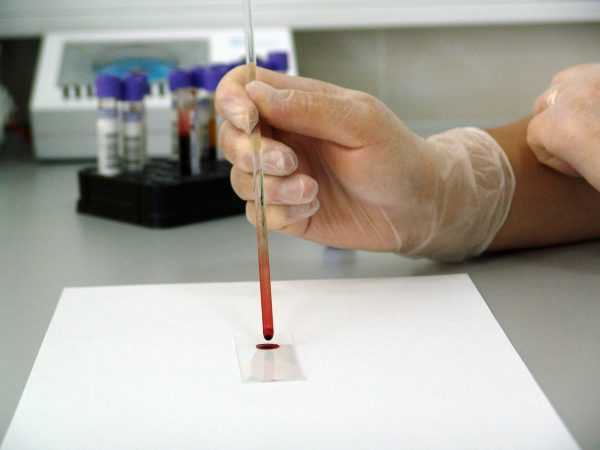 Проведение анализа крови в лаборатории