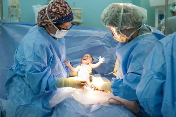 Проводится операция кесарево сечение, медик извлекает ребёнка