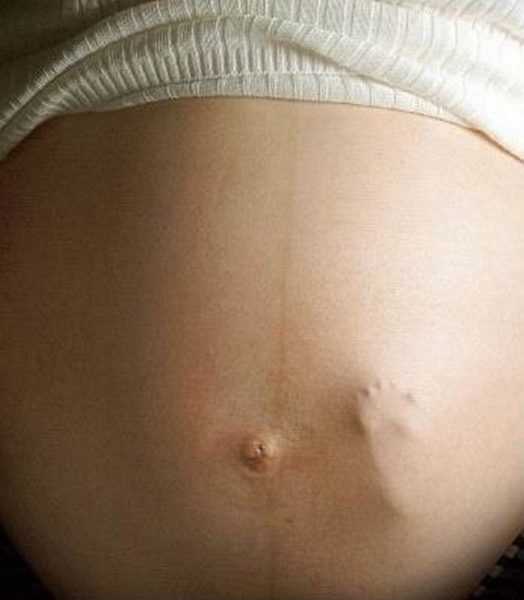 На животе беременной виден отпечаток ножки ребёнка