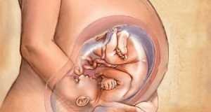 Ребенок располагается в утробе головным затылочным предлежанием