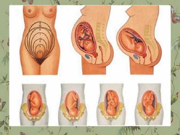 Варианты головного предлежания плода в материнской утробе